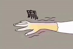 ＂肿瘤患者福音：黄芪桂枝五物汤，缓解化疗手